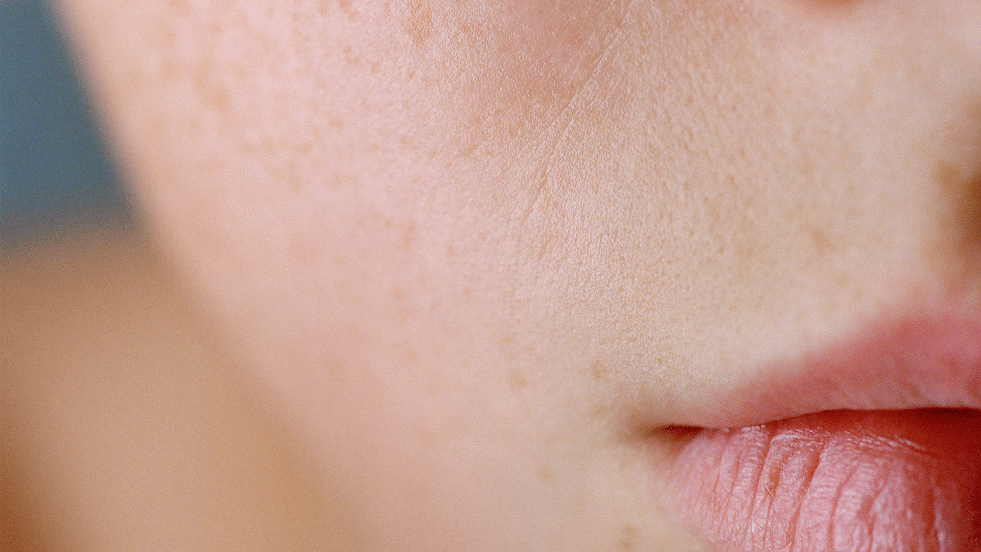 Kulit dehidrasi wajah